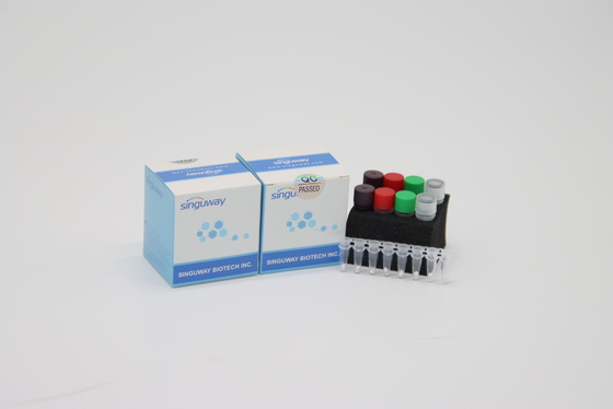 Bộ dụng cụ chẩn đoán PCR thời gian thực HIV có độ chính xác cao POCT IVD Bộ dụng cụ chẩn đoán PCR thời gian thực lâm sàng