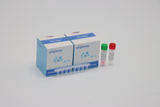 Bộ phát hiện PCR huỳnh quang định lượng vi rút HIV POCT Thời gian thực CE