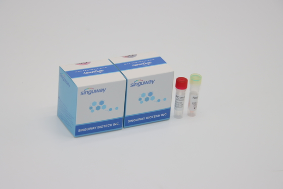 Bộ phát hiện PCR huỳnh quang định lượng IVD cho tất cả các đột biến vi rút Corona