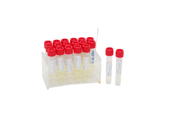 Bộ lấy mẫu vi rút dùng một lần 2mL Ống nghiệm y tế VTM với que ngoáy họng